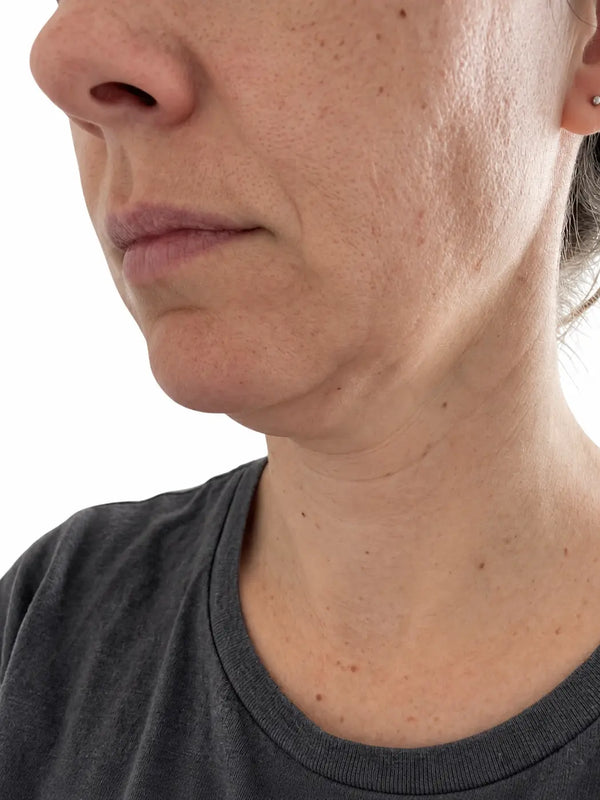 Avant · Stella, 42 ans · Double menton · 4 semaines