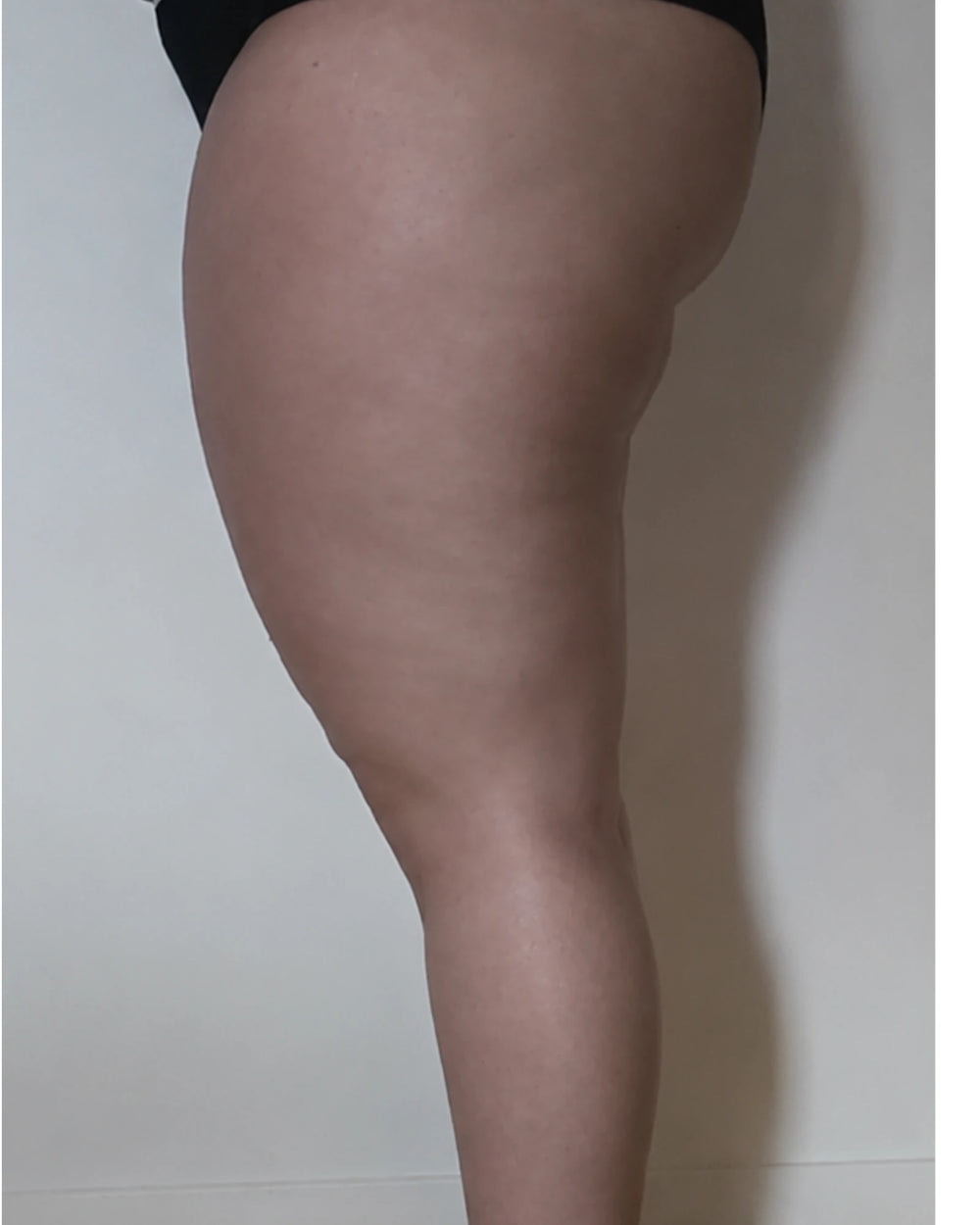 Après, cuisses