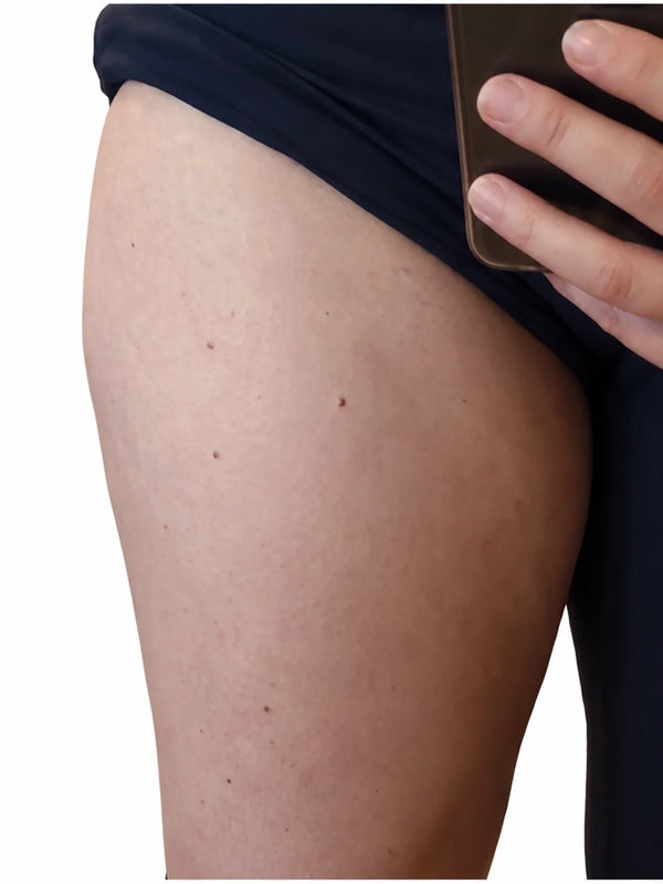 Après · Marie, 30 ans · Cuisses · 2 semaines